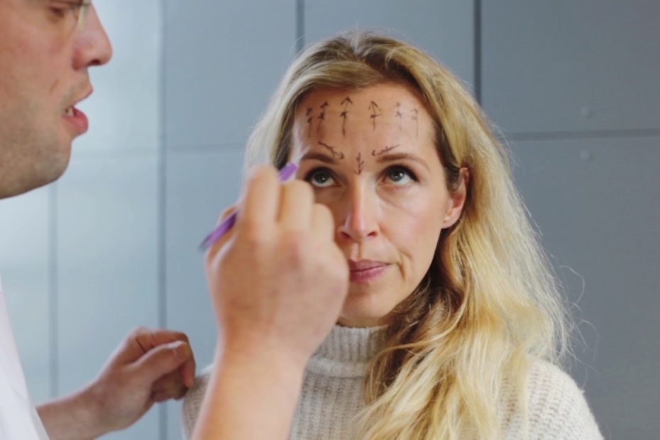 Botox gaat fout | Furrow.nl